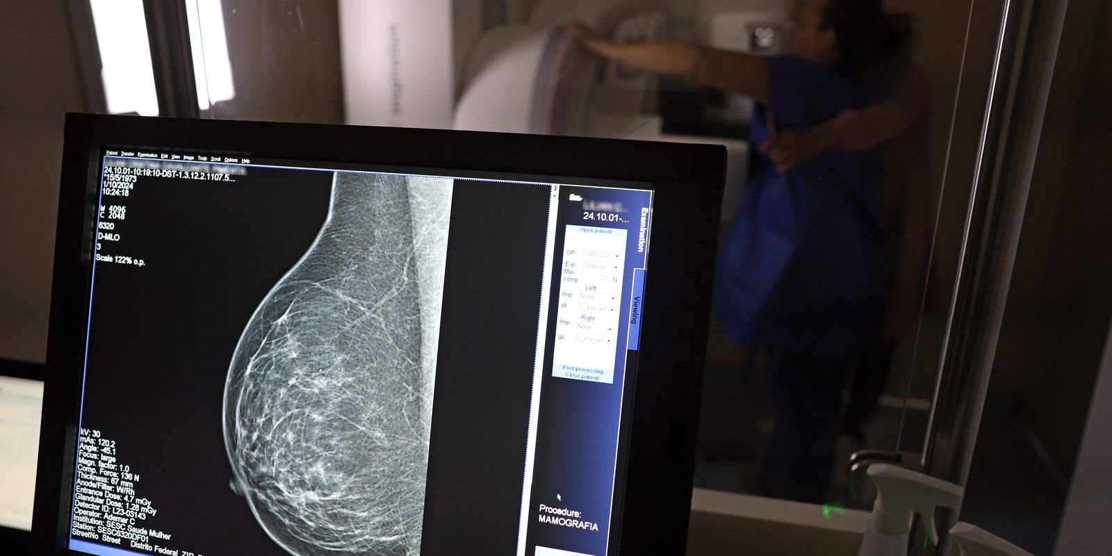 medicos-lancam-guia-para-evitar-recusa-de-mamografia-digital